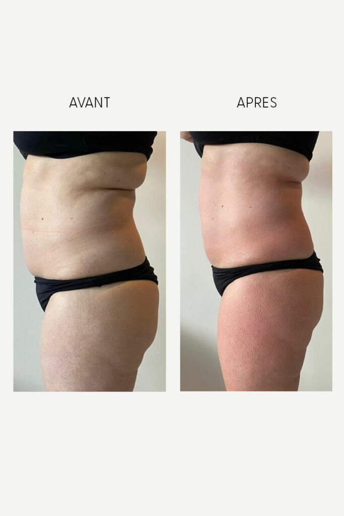 Résultats visibles d’une cure bien-être Millodie en Seine-et-Marne