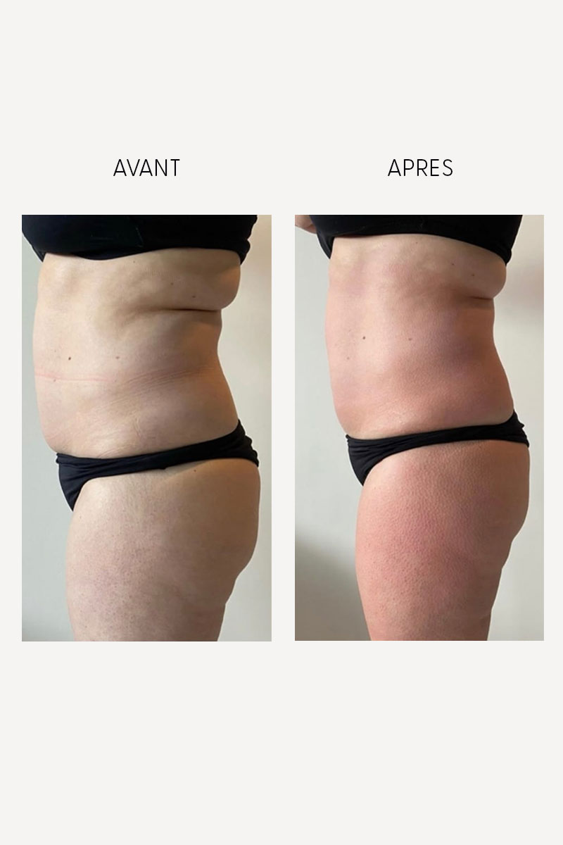 Résultats visibles d’une cure bien-être Millodie en Seine-et-Marne